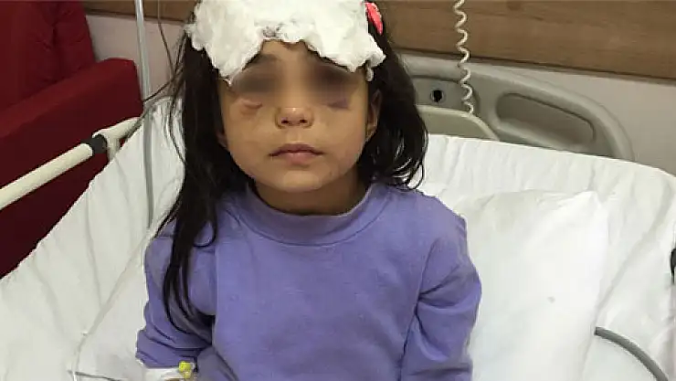 Üvey annesinin dövdüğü kız çocuğu devlet korumasına alınıyor