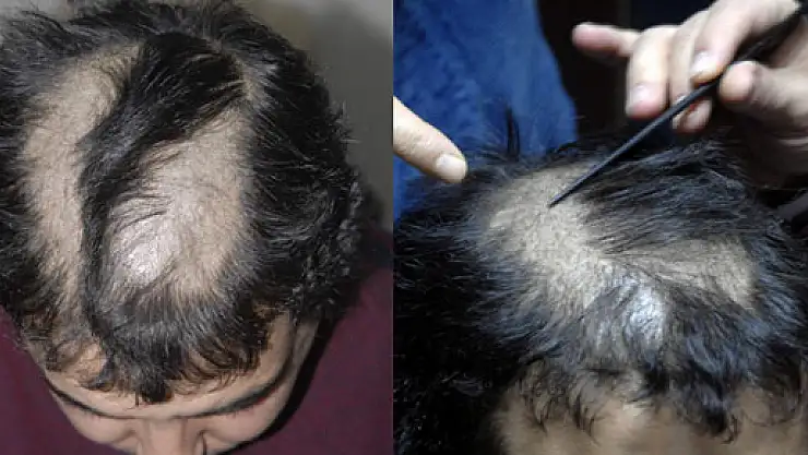 İlaç kurbanı berber!