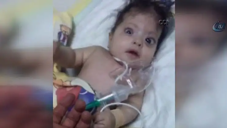 Domuz gribi teşhisi konulan bebek başka bebeklerle aynı yatakta