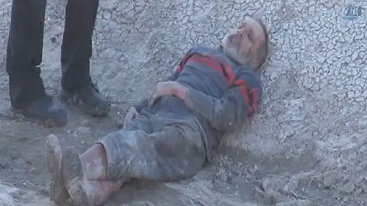 Yaşlı adam 1 hafta boyunca saçlarını yiyerek beslendi