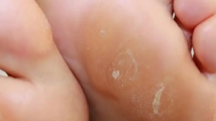 Yalın ayak yürümeyin!