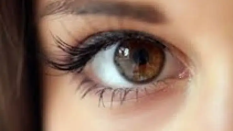 Alkol ve sigara gözleri bitiriyor