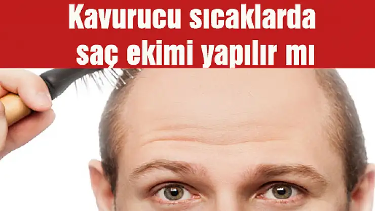 Kavurucu sıcaklarda saç ekimi yapılır mı?