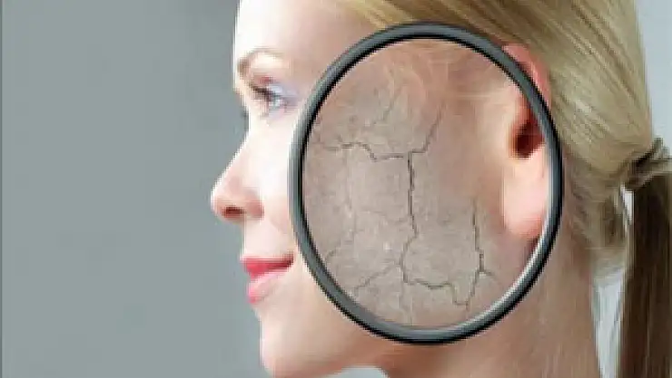 Sıcaklar hassas ciltleri tehdit ediyor