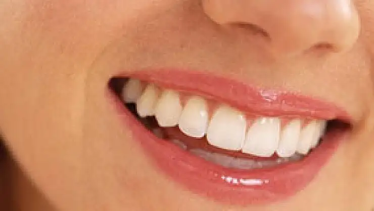 İmplant tedavisi nasıl yapılır?