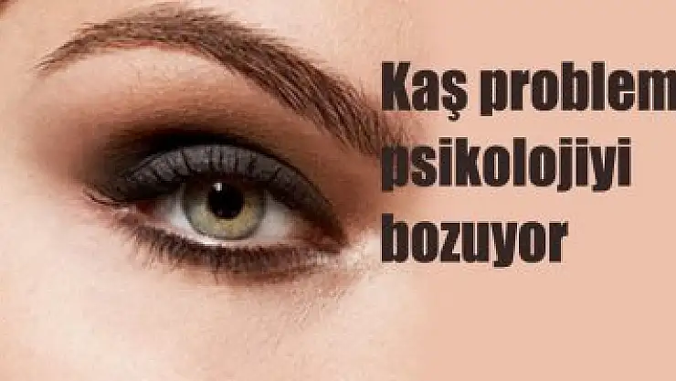 Kaş problemi psikolojiyi bozuyor