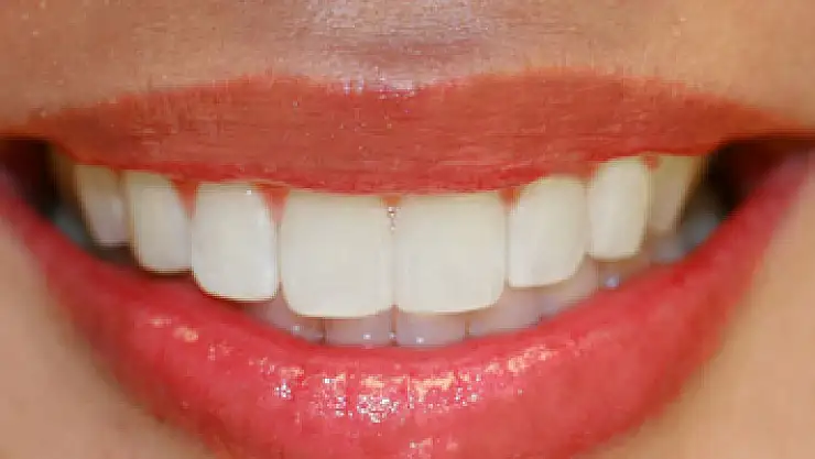 Diş fırçasını asla ıslatmayın