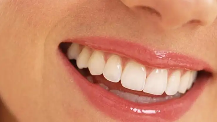 Bembeyaz dişlere sahip olmak artık çok daha kolay