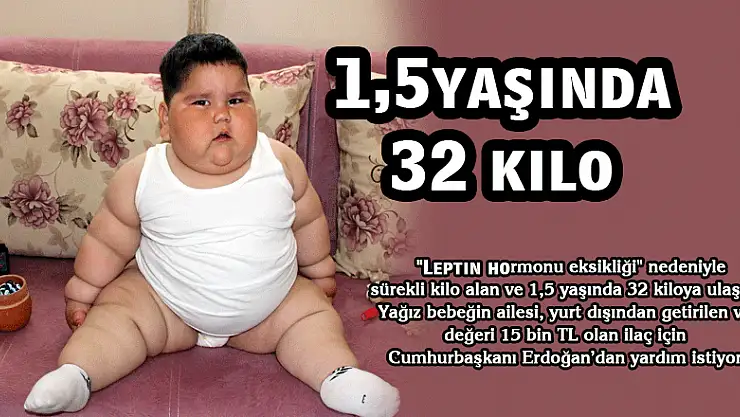  1,5 yaşında 32 kilo