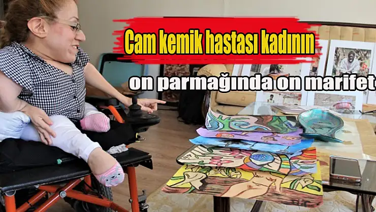 Cam kemik hastası kadının on parmağında on marifet
