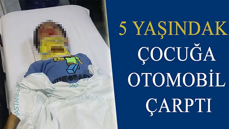 5 yaşındaki çocuğa otomobil çarptı