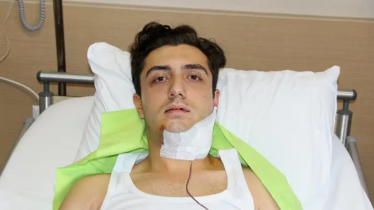 Trafik tartışmasında tek yumrukla çenesini kıran şahsın yakalanmasını istiyor 