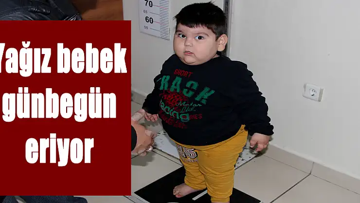 Yağız bebek günbegün eriyor