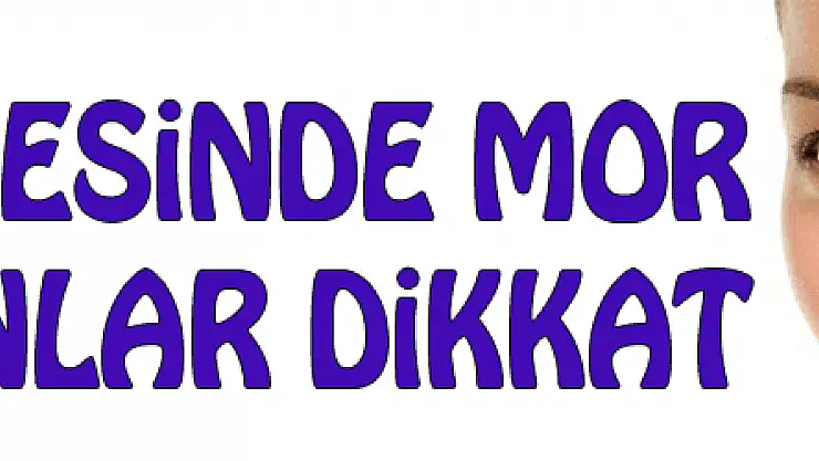 Göz çevresinde mor hale olanlar dikkat