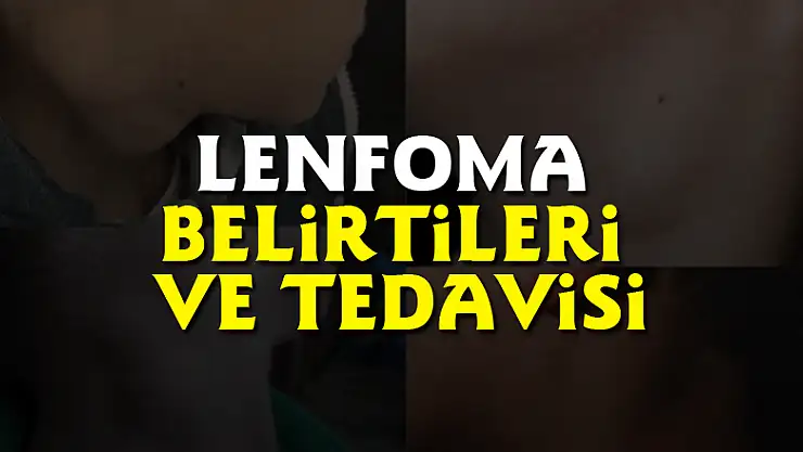 Lenfoma belirtileri ve tedavisi