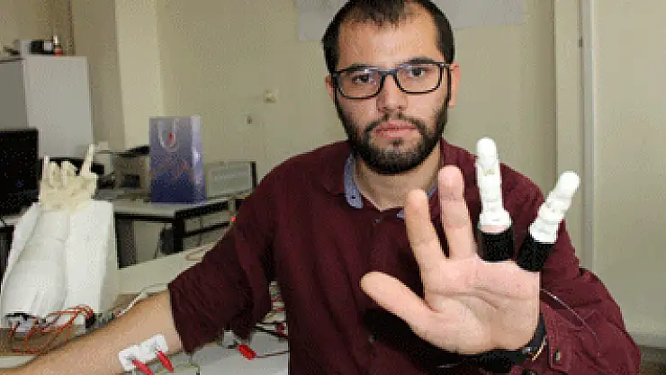 İki parmağını kaybeden mühendislik öğrencisi, kendine protez parmak yaptı