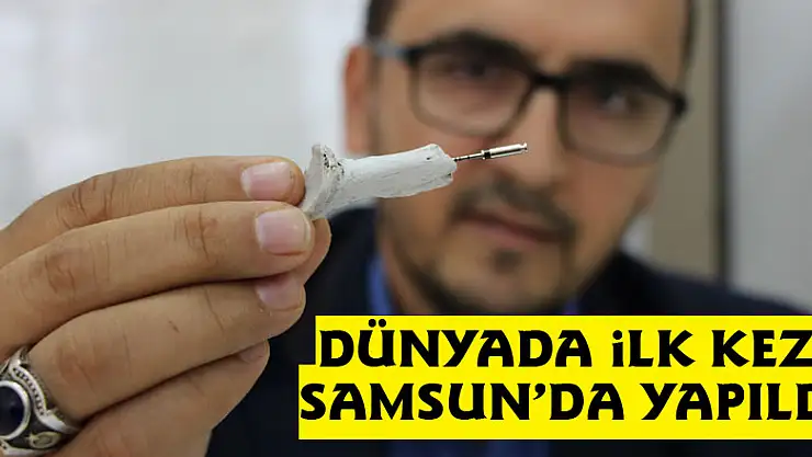 Dünyada ilk kez Samsun'da yapıldı