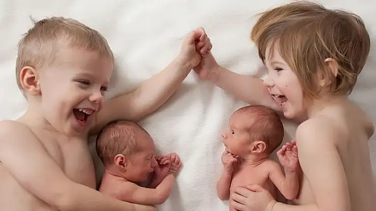 'Kafatası şekil bozuklukları ikiz ve erkek bebeklerde daha çok görülüyor'