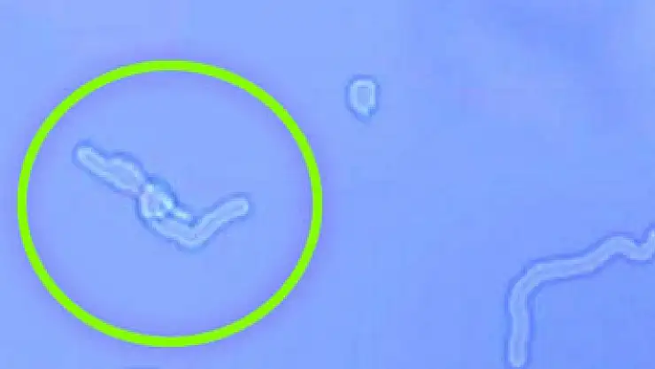 Gözünüzün önünde uçuşan sineklere dikkat