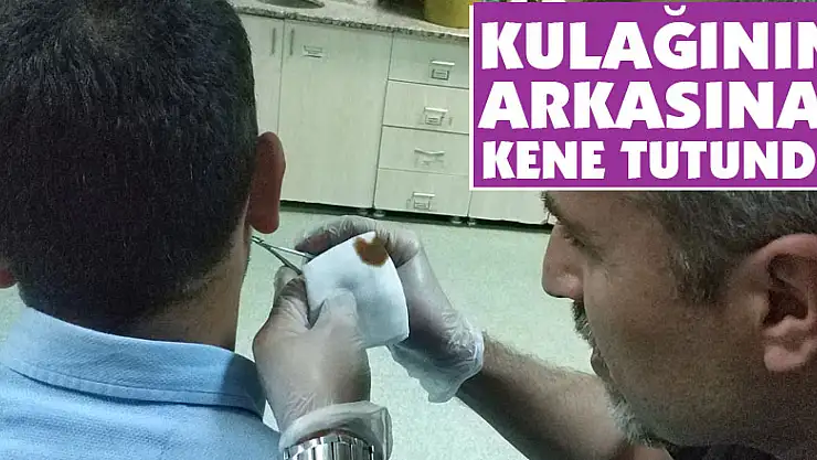 Kulağının arkasına kene tutundu