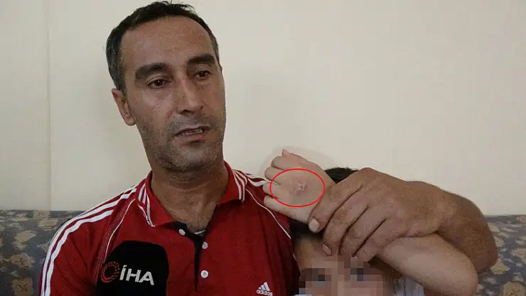 7 yaşındaki çocuğa ayrı yaşadığı annesi tarafından işkence iddiası 