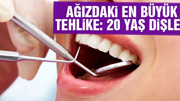 Ağızdaki en büyük tehlike: 20 yaş dişleri