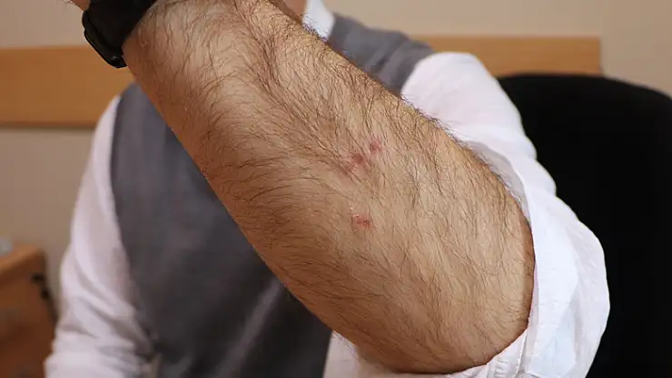 Profesörü köpek ısırdı, ameliyatları aksadı