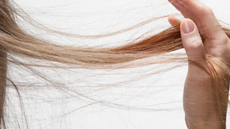 Vitamin eksikliği saçları döküyor