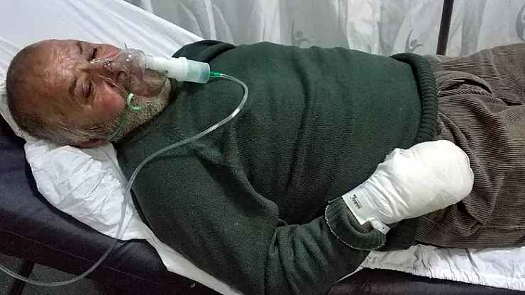 Yangında hayvanları kurtarmak isterken hastanelik oldu