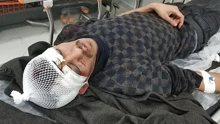 Evin kapısını kırıp sopayla 2 kişiyi hastanelik ettiler