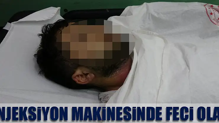 800 derecelik enjeksiyon makinesine sıkışan işçi ağır yaralandı