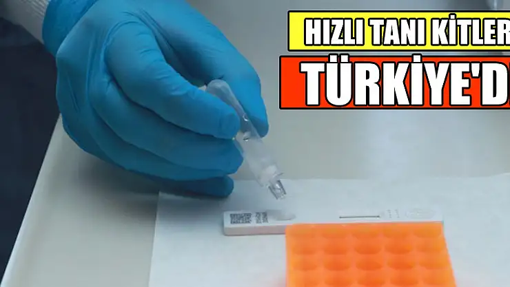 Hızlı tanı kitleri Türkiye'de