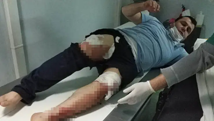 2 aylık bebeğin ağlama sesinden rahatsız olan komşuların kavgasında 5 kişi hastanelik oldu