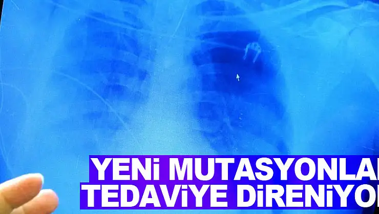 Yeni mutasyonlar tedaviye direniyor
