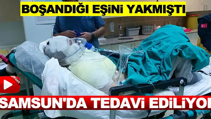 Eski eşi tarafından yanıcı maddeyle yaralanan kadın Samsun'da tedavi ediliyor