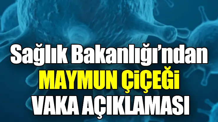 Sağlık Bakanlığı'ndan maymun çiçeği  vaka açıklaması