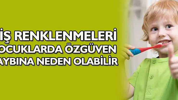 Diş renklenmeleri çocuklarda özgüven kaybına neden olabilir