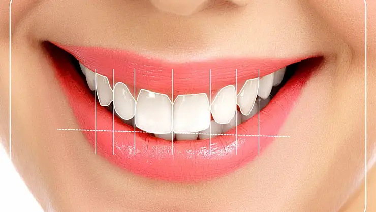 Hollywood gülüşü ile estetik görünüm