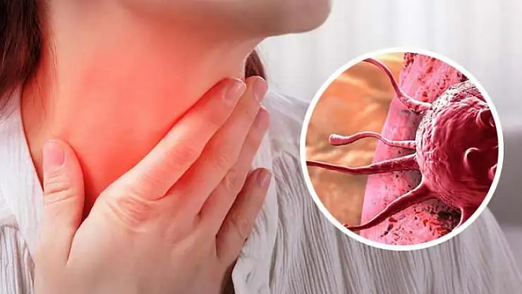 Nedensiz ateş ve terleme lenfoma işareti olabilir