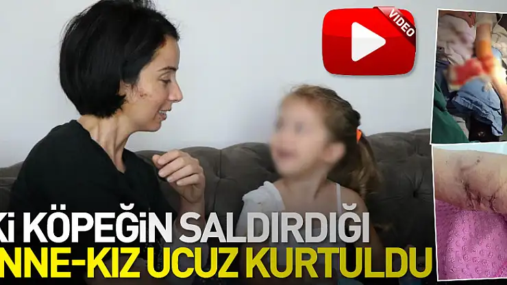 İki köpeğin saldırdığı anne-kız ucuz kurtuldu