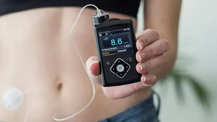 'Yeni nesil akıllı insülin pompaları hasta konforunu artırıyor'