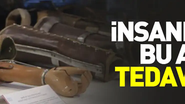 İnsanlar eskiden bu aletlerle tedavi ediliyordu