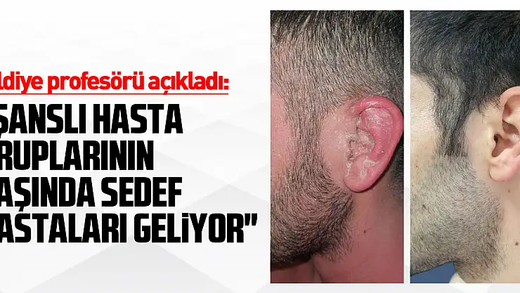 Cildiye profesörü açıkladı: 'Artık günümüzde şanslı hasta gruplarının başında sedef hastaları geliyor'