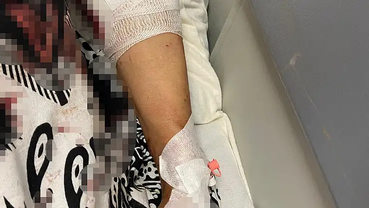 Bahçeye çıkan kadına köpekler saldırdı