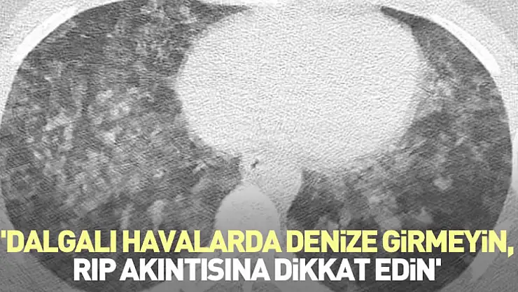 'Dalgalı havalarda denize girmeyin, RIP akıntısına dikkat edin'