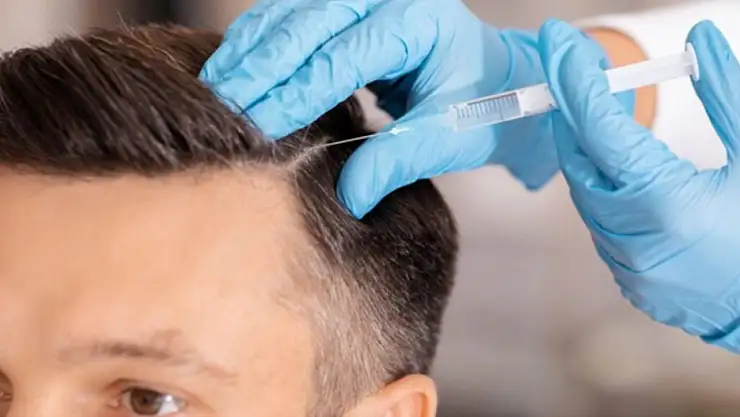 Exosome Saç Tedavisi Nedir?