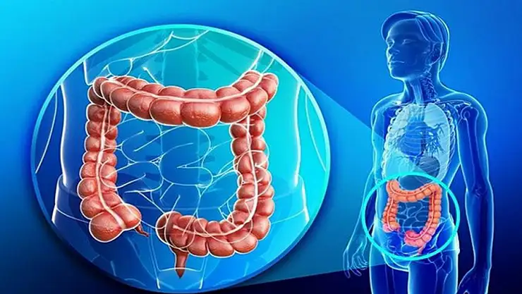 'Kolorektal kansere davetiye çıkarıyor'