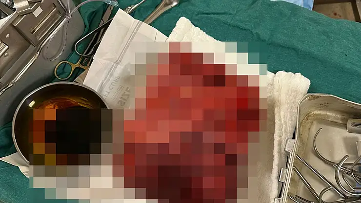 Nefes darlığıyla gitti gördüklerine inanamadı