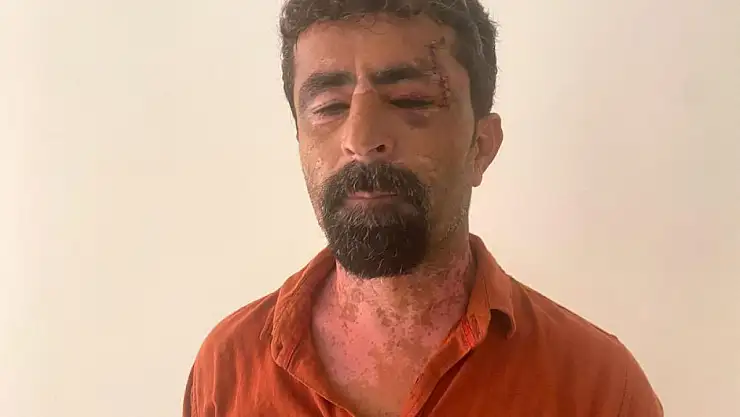 Öfkeli damat kayınpederini hastanelik etti