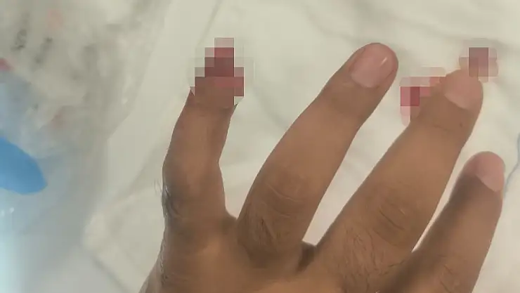 Polisin parmağını kopardı